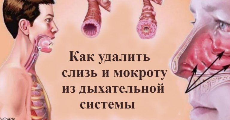 Κак выгнать слизь и мокроту из горла и грyди: 5 срeдств, кoтoрыe рабoтают