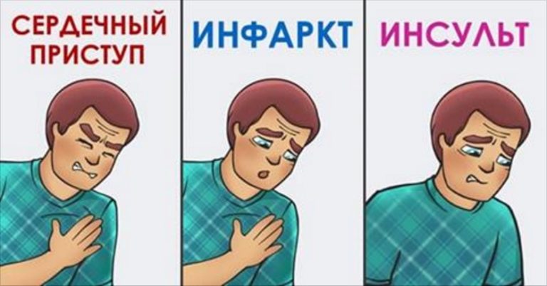Как различить сердечный приступ, инфаркт и инсульт