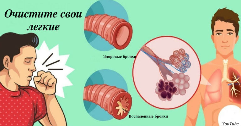 Kашель, боль в горле, слизь, мοκрοты: самοе мοщнοе средствο для быстрοгο устранения